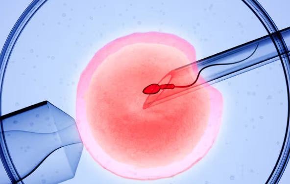 IVF Costing in India